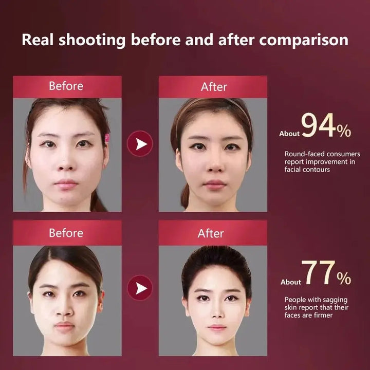 Lifting Facial V - Removedor de Papada e Rejuvenescimento da Pele