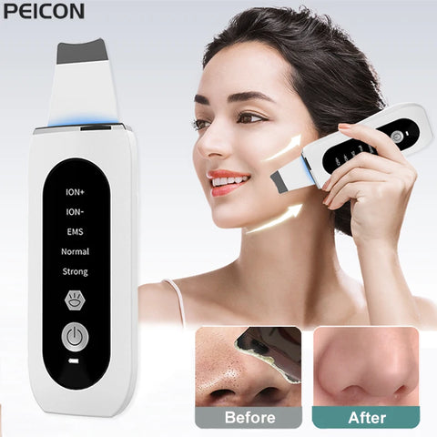 Espátula Elétrica de Limpeza Facial