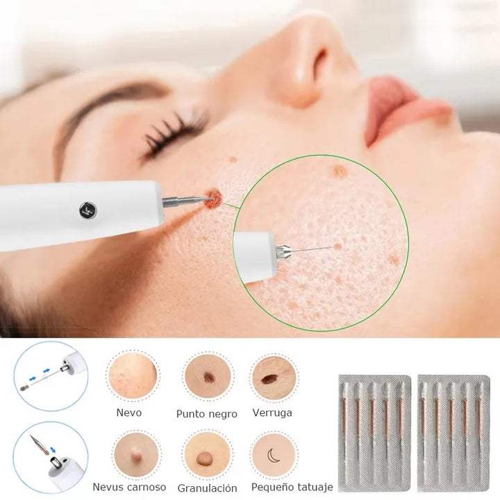 SkinPro Laser – Removedor de Manchas e Verrugas.