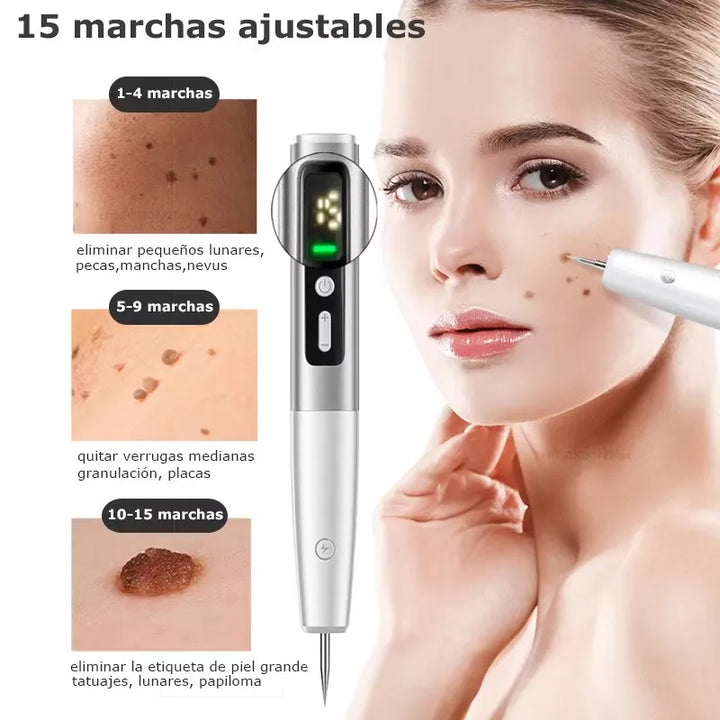 SkinPro Laser – Removedor de Manchas e Verrugas.